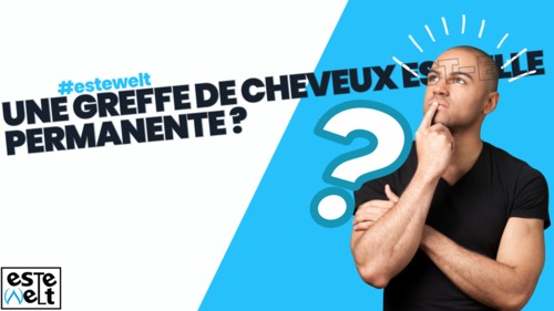 Une greffe de cheveux est-elle permanente ?