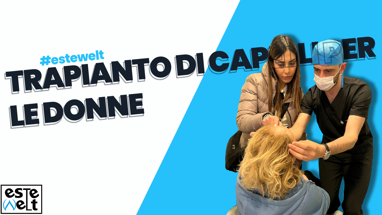 Trapianto di capelli per le donne