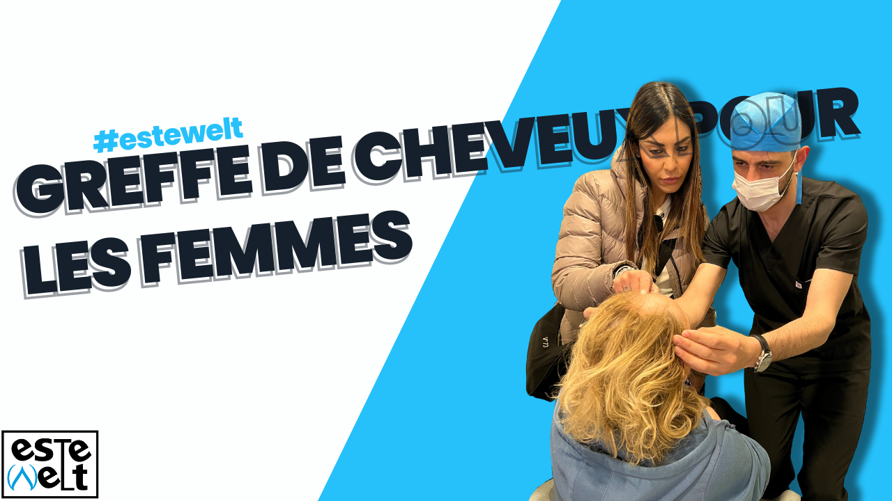 Greffe de cheveux pour les femmes