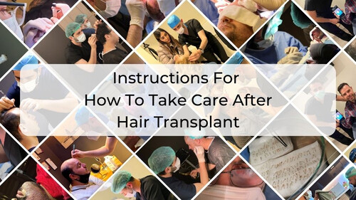 Instructions For How To Take Care After Hair Transplant